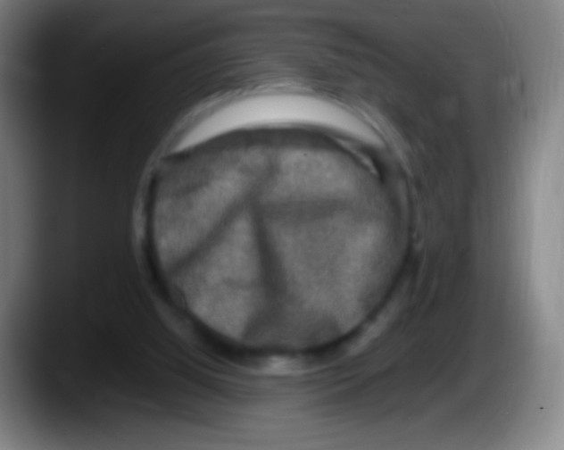 X0000087620060200705252011