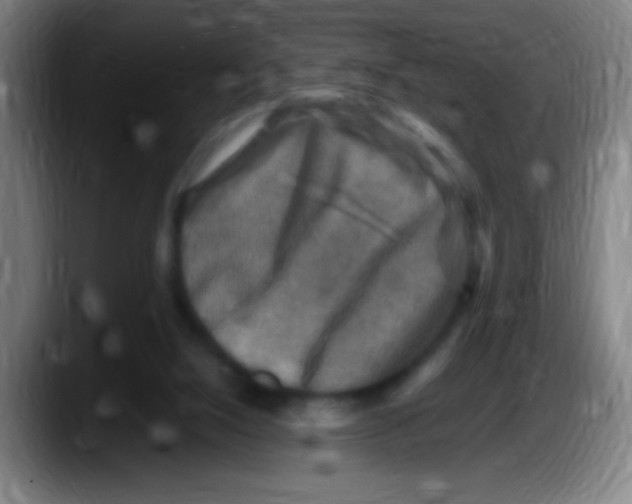 X0000087620064200705252011