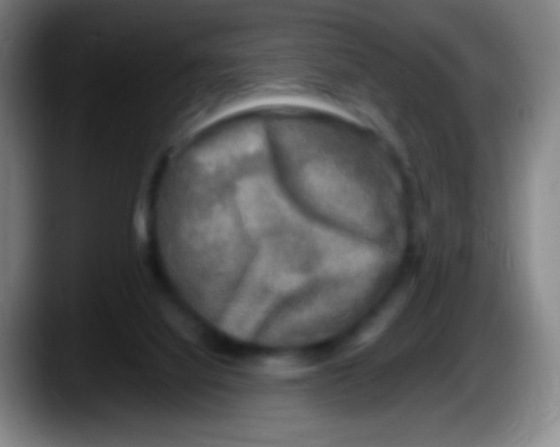 X0000087620068200705252011