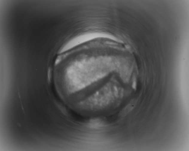 X0000087620070200705252011