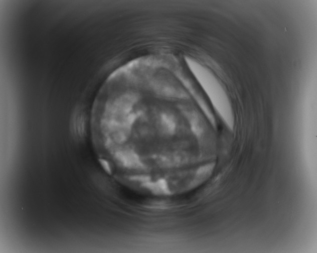 X0000087620071200705252011
