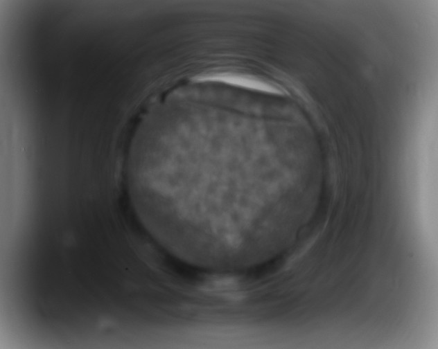 X0000087620073200705252011