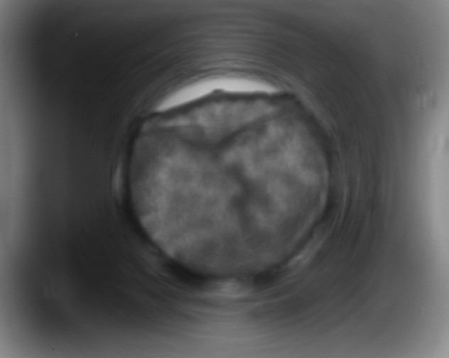 X0000087620074200705252011