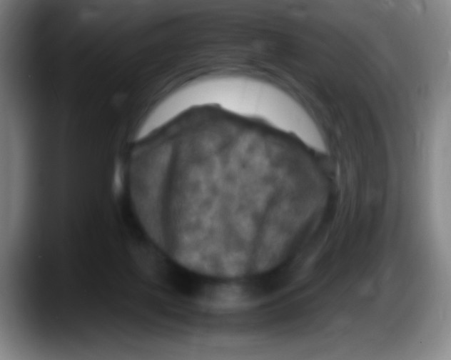 X0000087620075200705252011
