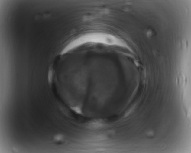 X0000087620076200705252011