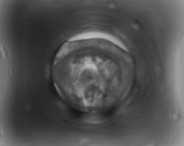 X0000087620077200705252011