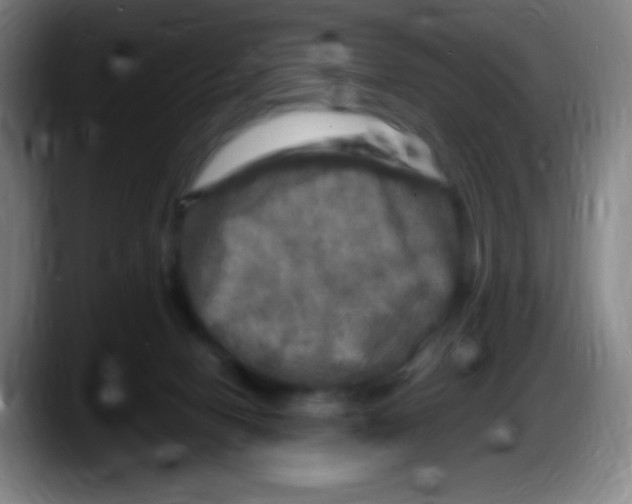 X0000087620078200705252011