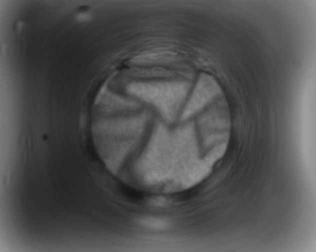X0000087620079200705252011