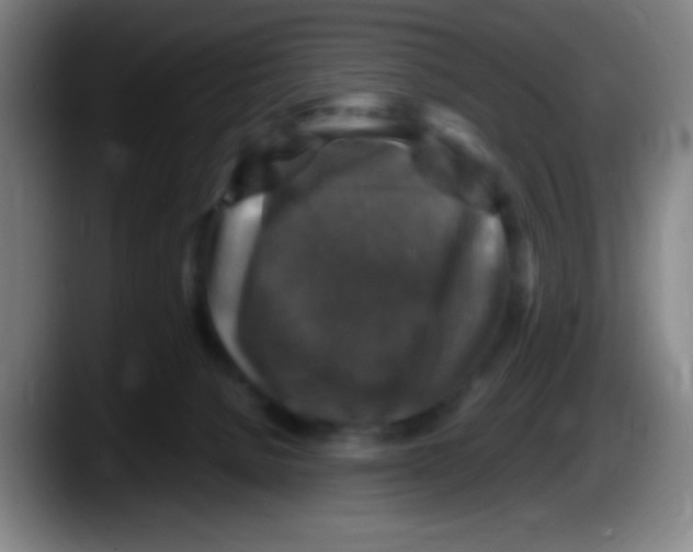 X0000087620080200705252011