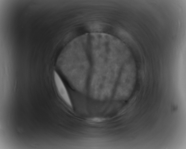 X0000087620081200705252011