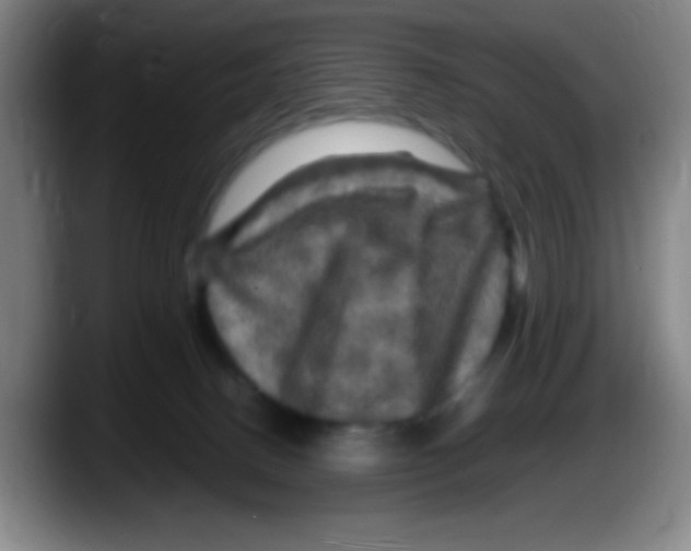 X0000087620082200705252011