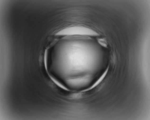 X0000087620084200705252011