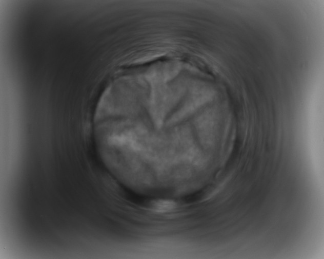 X0000087620085200705252011