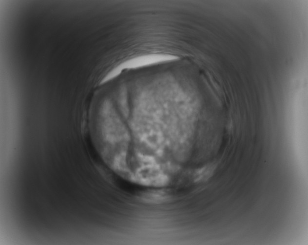 X0000087620086200705252011