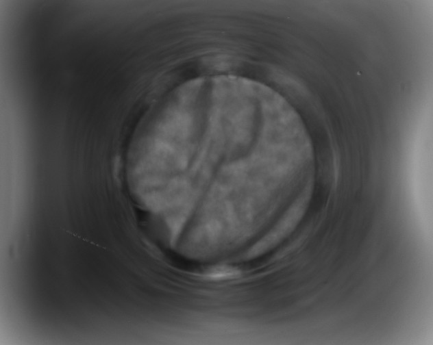X0000087620087200705252011