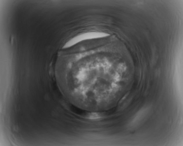 X0000087620091200705252011