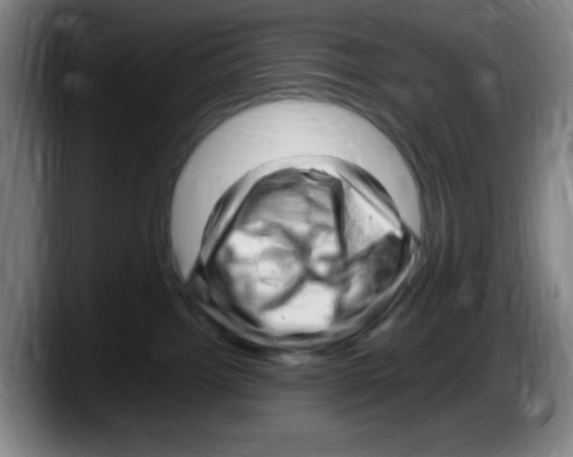 X0000087620092200705252011