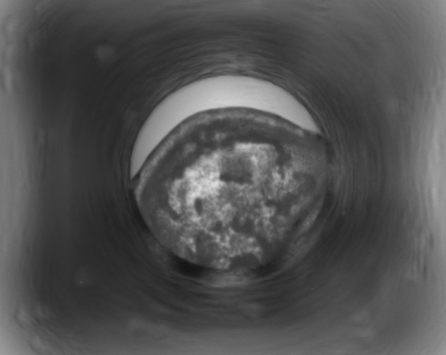 X0000087620093200705252011