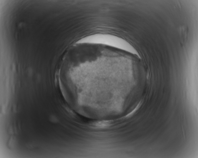 X0000087620094200705252011