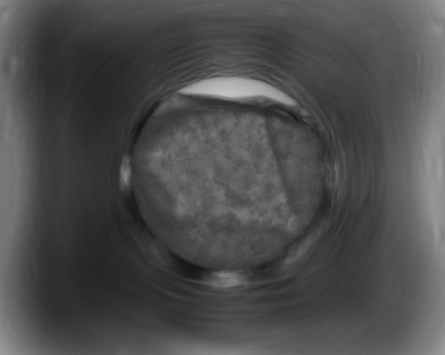X0000087620095200705252011