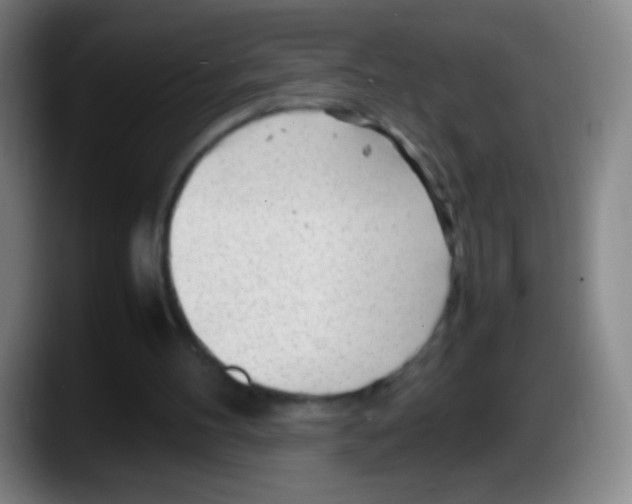 X0000087620100200705252011