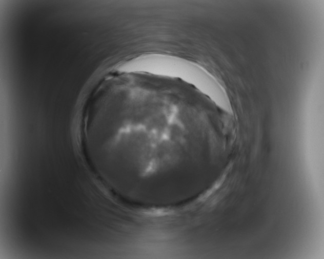 X0000087620101200705252011