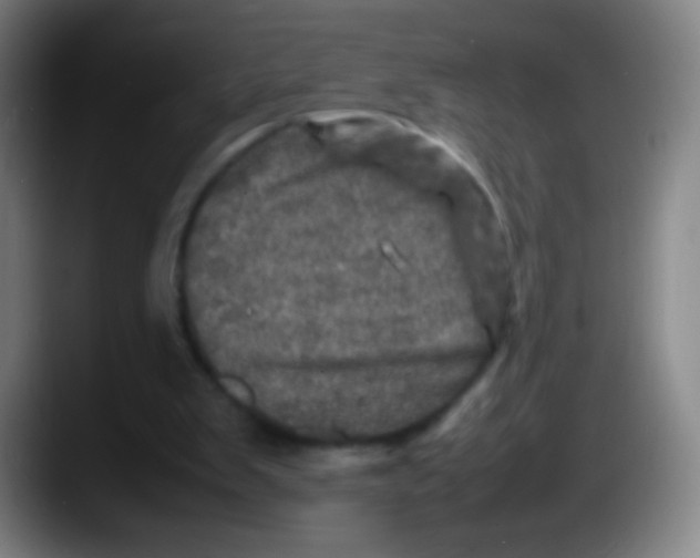 X0000087620103200705252011