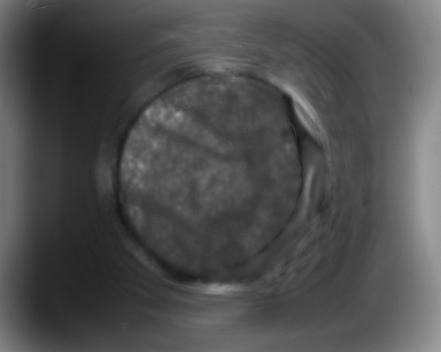 X0000087620105200705252010