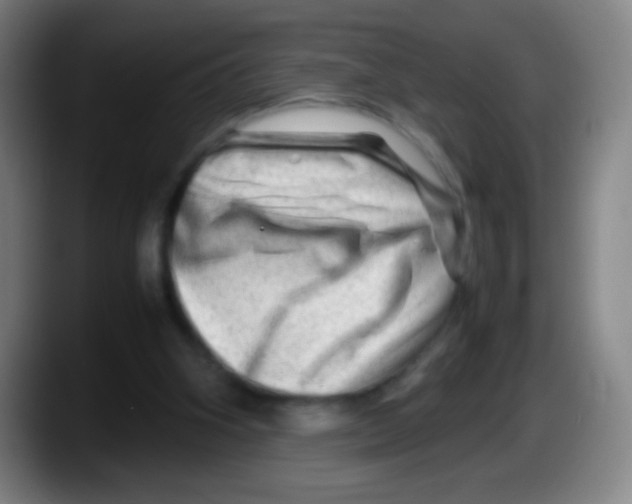 X0000087620106200705252010