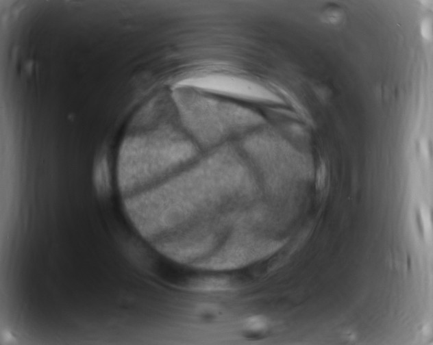 X0000087620110200705252010