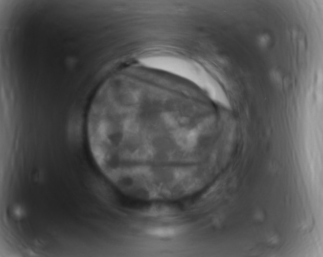 X0000087620111200705252010