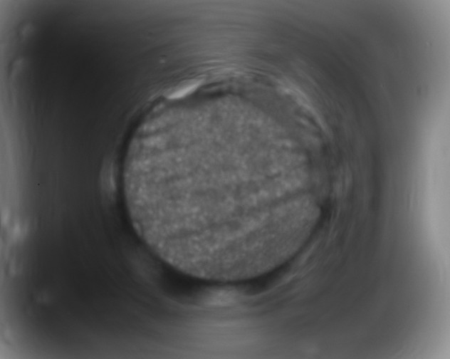 X0000087620115200705252010