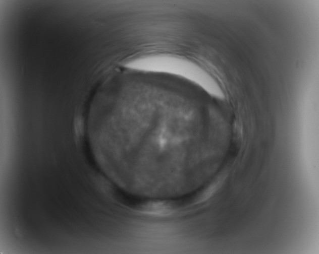 X0000087620117200705252010