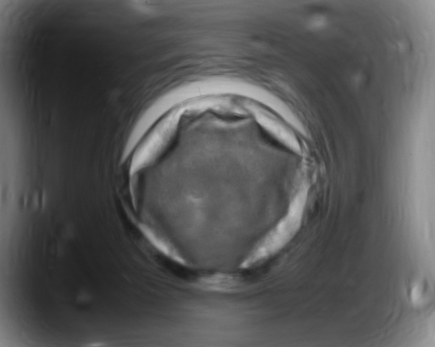 X0000087620125200705252010