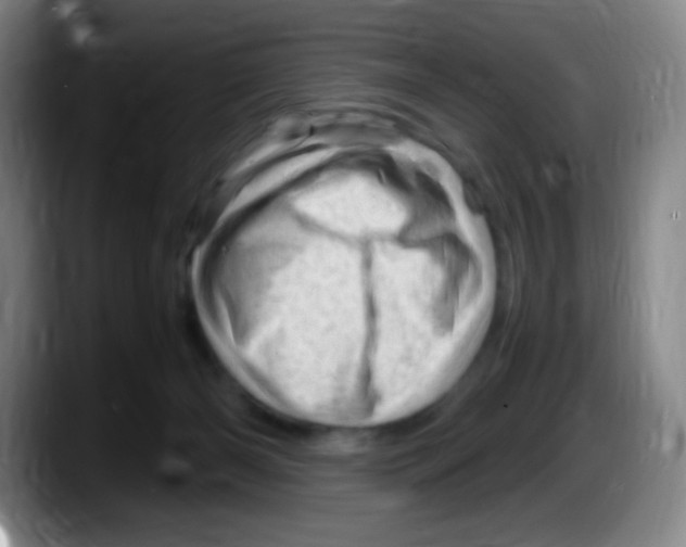 X0000087620126200705252010
