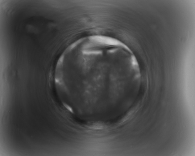 X0000087620127200705252010