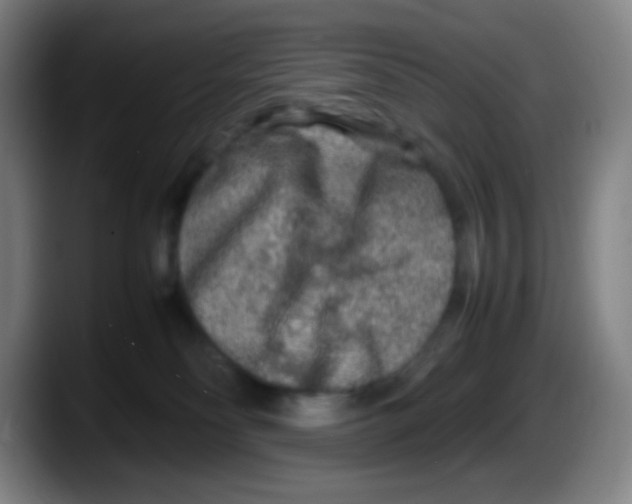 X0000087620134200705252010