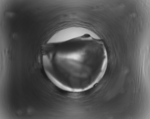 X0000087620139200705252010