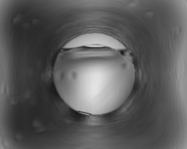 X0000087620141200705252010