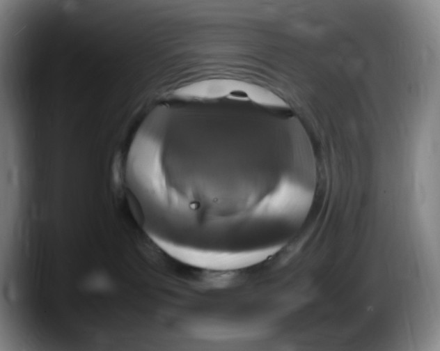 X0000087620143200705252010