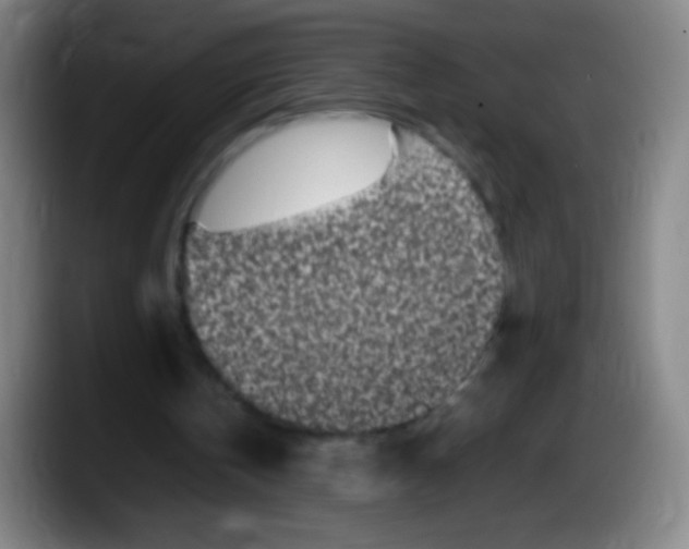 X0000087620146200705252009