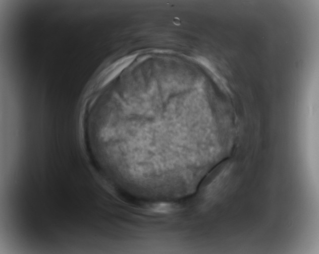 X0000087620151200705252009