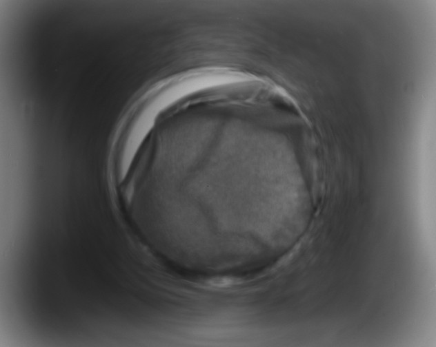 X0000087620152200705252009