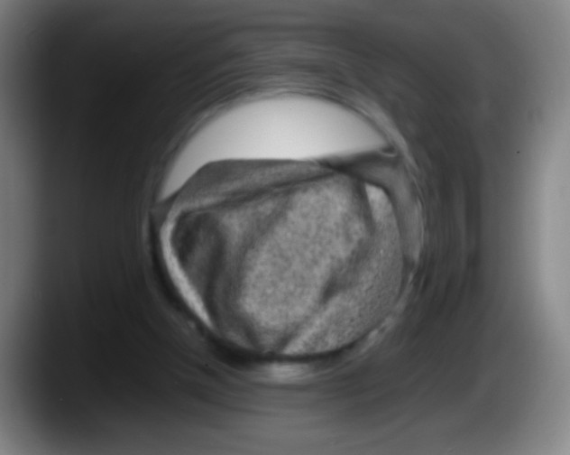 X0000087620154200705252009