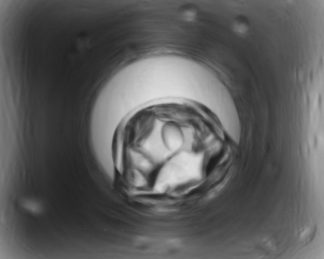 X0000087620158200705252010