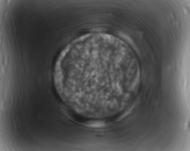X0000087620161200705252010