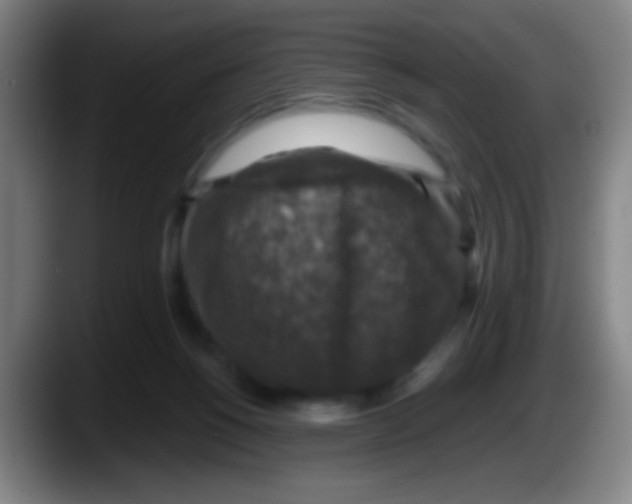 X0000087620168200705252010