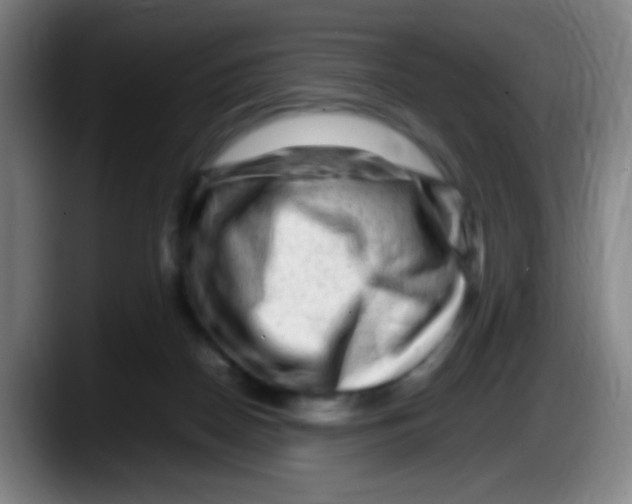X0000087620170200705252010