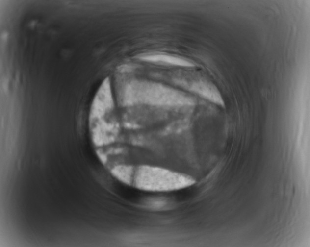 X0000087620171200705252010