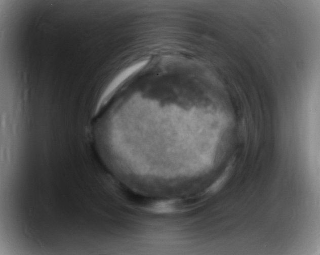 X0000087620178200705252010